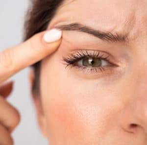 Blepharoplasty Crestview & Okaloosa County