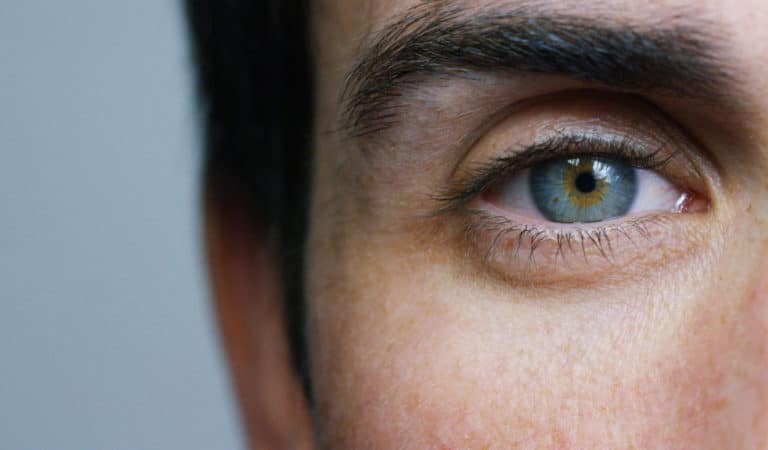 How Long Does LASIK Last?