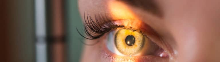 How Long Does Cataract Surgery Take?