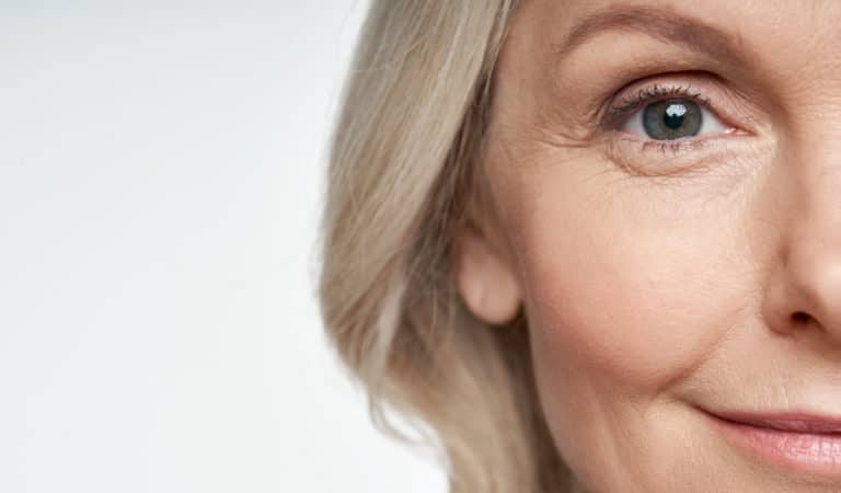 What are the Benefits of a Brow Lift?