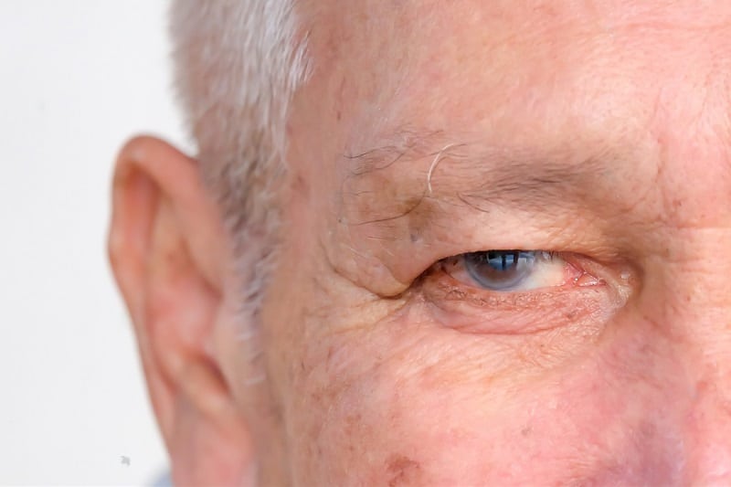 Stock-photo-examination-and-treatment-of-patients-with-cataract-and-glaucoma-eyes-glaucoma-concept-senior-man-1651507696-transformed - Alabata Eye Center Glaucoma